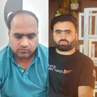 کاشتموبا کیفیت|خدمات آرایشگری و زیبایی|رشت, گلسار|دیوار