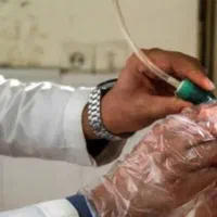 حجامت و فصد و زالو درمانی(مرکزی یزد.باغ ملی)