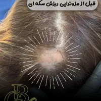 فیشیال.کربن.لیزر.لاغری.هایفو|خدمات آرایشگری و زیبایی|کرج, کوی زنبق|دیوار