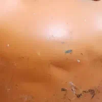 کپسول گاز