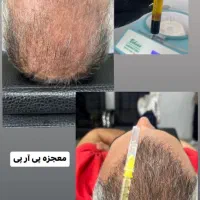 ژل بوتاکس آموزش تخصصی در مطب|خدمات آرایشگری و زیبایی|اصفهان, شهرک کاوه|دیوار