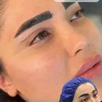 بلفاروپلاستی،ساکشن غبغب،بوکال فت،سانترال لب