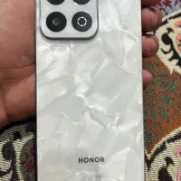 گوشی HONOR X7c