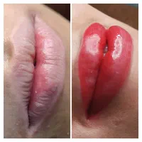 فیبروز میکرو شیدینگ خط چشم ارایش دائم