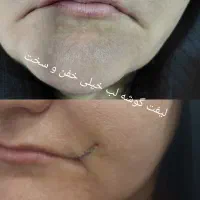 تخفیف ویژه خدمات زیبایی|خدمات آرایشگری و زیبایی|کوهدشت, |دیوار