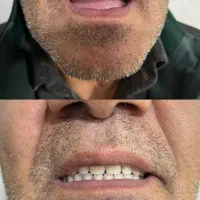 دندانسازی محلات|خدمات آرایشگری و زیبایی|محلات, |دیوار