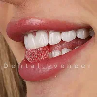 دندانپزشکی لمینت الهیه منطقه ۱ کامپوزیت سرامیکی|خدمات آرایشگری و زیبایی|تهران, الهیه|دیوار