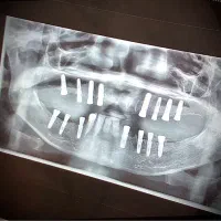 نیازمند متخصص پریو و فک و صورت