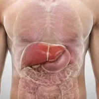 چربی کبدتو ذوب کن تضمینی