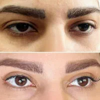 بلفاروپلاستی(پلک بالا و پایین) لیفت، غبغب|خدمات آرایشگری و زیبایی|شیراز, قصرالدشت|دیوار
