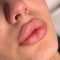 خدمات پوست و‌مو توسط پزشک