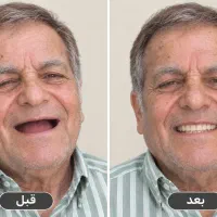 لابراتوارساخت پروتز متحرک وثابت