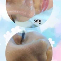 مدل فیشیال ویژه با یکبار فیشیال تغییر رااحساس کنید|خدمات آرایشگری و زیبایی|کرج, گلشهر|دیوار