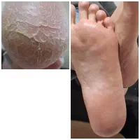 پدیکور درمانی آقایان در کلینیک پوست دریک‌جلسه|خدمات آرایشگری و زیبایی|پردیس, فاز ۲|دیوار