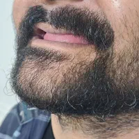 دندانسازی تخصصی|خدمات آرایشگری و زیبایی|بهبهان, |دیوار