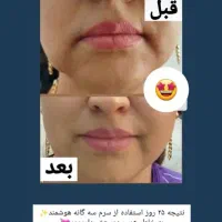 مشاوره تخصصی پوست ومووپیشنهادبهترین محصولات