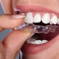 محافظ دندان(نایت گارد)