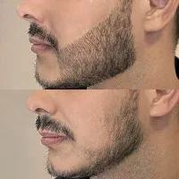 ریشاتو جذاب کن