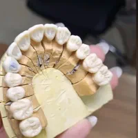 آموزش چینی گذاری