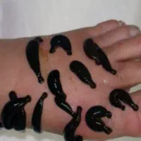 حجامت و طب سنتی در مطب پزشک|خدمات آرایشگری و زیبایی|اصفهان, مهدی آباد|دیوار