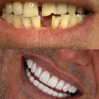 خدمات کامپوزیت آفر