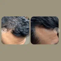 جذاب شو|آرایشی، بهداشتی، درمانی|کوهنانی, |دیوار