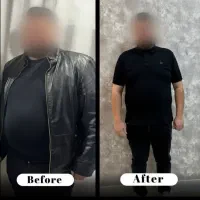 لاغری ریشه ای بدون بازگشت و عوارض