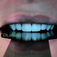 دندان پزشکی لبخند سفید|خدمات آرایشگری و زیبایی|ماهنشان, |دیوار