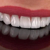 دندانپزشکی کامپوزیت و درمانی|خدمات آرایشگری و زیبایی|تهران, سلسبیل جنوبی|دیوار