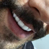 قالب ریز و فریم سنگ زن