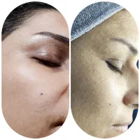اولین اتاق پوست صومعه سرا با تراپی های درمانی|خدمات آرایشگری و زیبایی|صومعه‌سرا, |دیوار