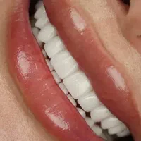 مرکز تخصصی زیبایی دندان در دوشعبه ورامین وتهران