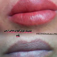 ریموو تک جلسه ای شیدینگ لب نچرال بروز شید چشم|خدمات آرایشگری و زیبایی|شیراز, عفیف‌آباد|دیوار