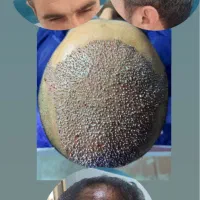 انجام کلیه خدمات پوست و مو