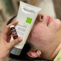 تخفیف ویژه پاکسازی پوست