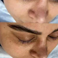 پاکسازی پوست