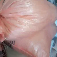 کاه عدس تازه