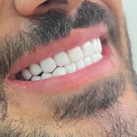 دندانپزشکی طرف قرارداد بیمه و اقساطی|خدمات آرایشگری و زیبایی|شیراز, قصرالدشت|دیوار