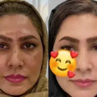 زیبایی باکرم های معجزه سوپر وی آی پی تجربه کنید