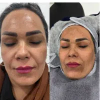 فیشال تخصصی صورت و بدن بانوان/آقایان