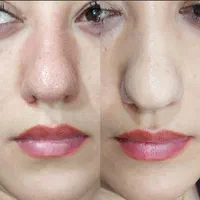 مدل تتو کاملا تخصصی.پلاسماجت(پلکسر)|خدمات آرایشگری و زیبایی|تهران, میدان ولیعصر|دیوار