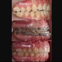 جشنواره ویژه دندانپزشکی و ارتودنسی|خدمات زیبایی و سلامت|تبریز, |دیوار