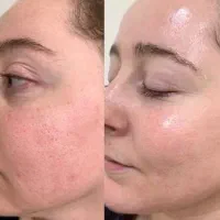 کرم سفیدکننده پوست وضدلک قوی گلدن کویین|آرایشی، بهداشتی، درمانی|مرودشت, مسجد رسول|دیوار