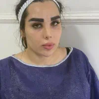 جشنواره کاشت ابرو و بلفارو پلاستی تا پایان مهر ماه