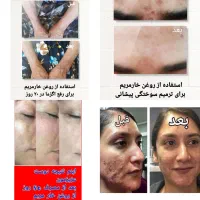 درمان بیماریها با محصولات صد درصد گیاهی