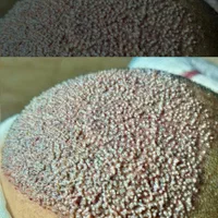کاشت مو طبیعی با جدید ترین روشfitوسوپرfut|خدمات آرایشگری و زیبایی|اهواز, زیتون کارمندی|دیوار