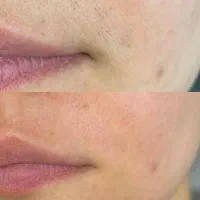 لیزر فول بادی فقط و فقط*۴۵۰ * بدوو که جا نمونی *|خدمات آرایشگری و زیبایی|زنجان, |دیوار