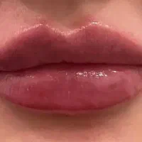 کلینیک زیبایی ژل و بوتاکس  شهرری