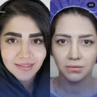 کاشت مو و ابرو در تهران (حتی اقساط)|خدمات زیبایی و سلامت|کرمانشاه, |دیوار
