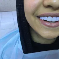 دندانپزشکی انجام تمامی خدمات دندانپزشکی|خدمات آرایشگری و زیبایی|تبریز, |دیوار